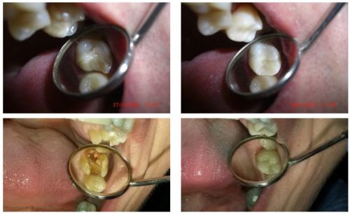 DentisGreen poza 2