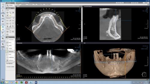VIZIODENT-x-ray diagnostic imaging services poza 1