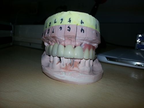 PRO DENT GLOBAL poza 0