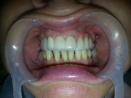 PRO DENT GLOBAL poza 2