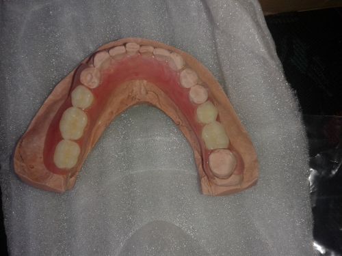 PRO DENT GLOBAL poza 4