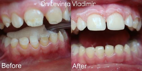 Dr. Vladimir Levința, Denta Clinica poza 10
