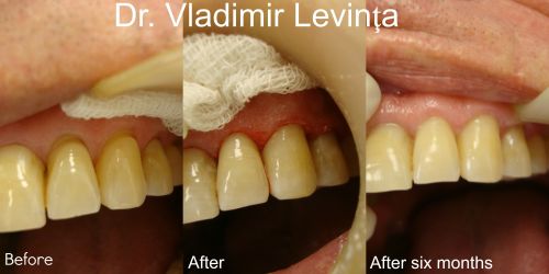 Dr. Vladimir Levința, Denta Clinica poza 8