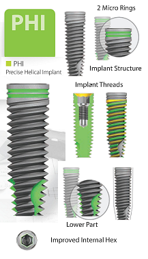 Precise Implant Systems Implant Dentar poza 1