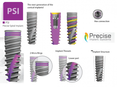 Precise Implant Systems Implant Dentar poza 2
