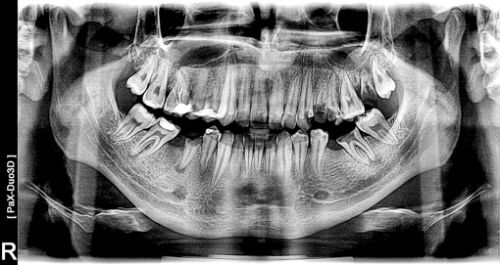Radiologie Dentara LLL Dental poza 3