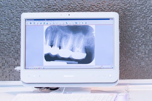 Radiologie Dentara LLL Dental poza 4