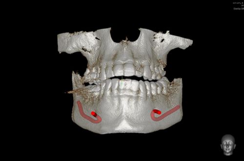 Radiologie Dentara LLL Dental poza 2
