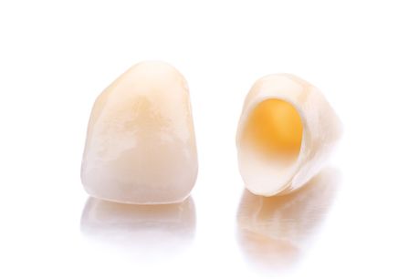 Laborator LLL Dental poza 4