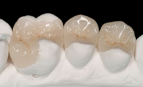 Laborator LLL Dental poza 3
