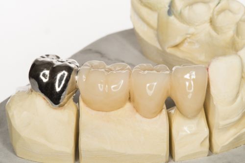 Laborator LLL Dental poza 6