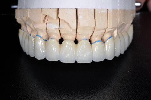 Laborator LLL Dental poza 7