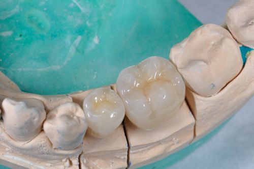 Laborator LLL Dental poza 5