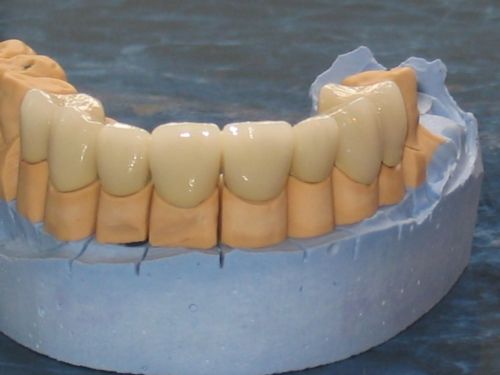 Laborator Dentar Szabo Claudia poza 4