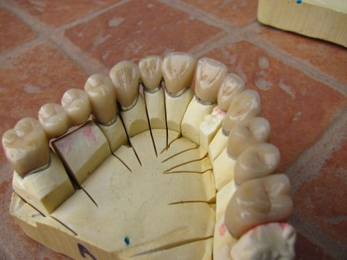 Laborator Dentar Szabo Claudia poza 5
