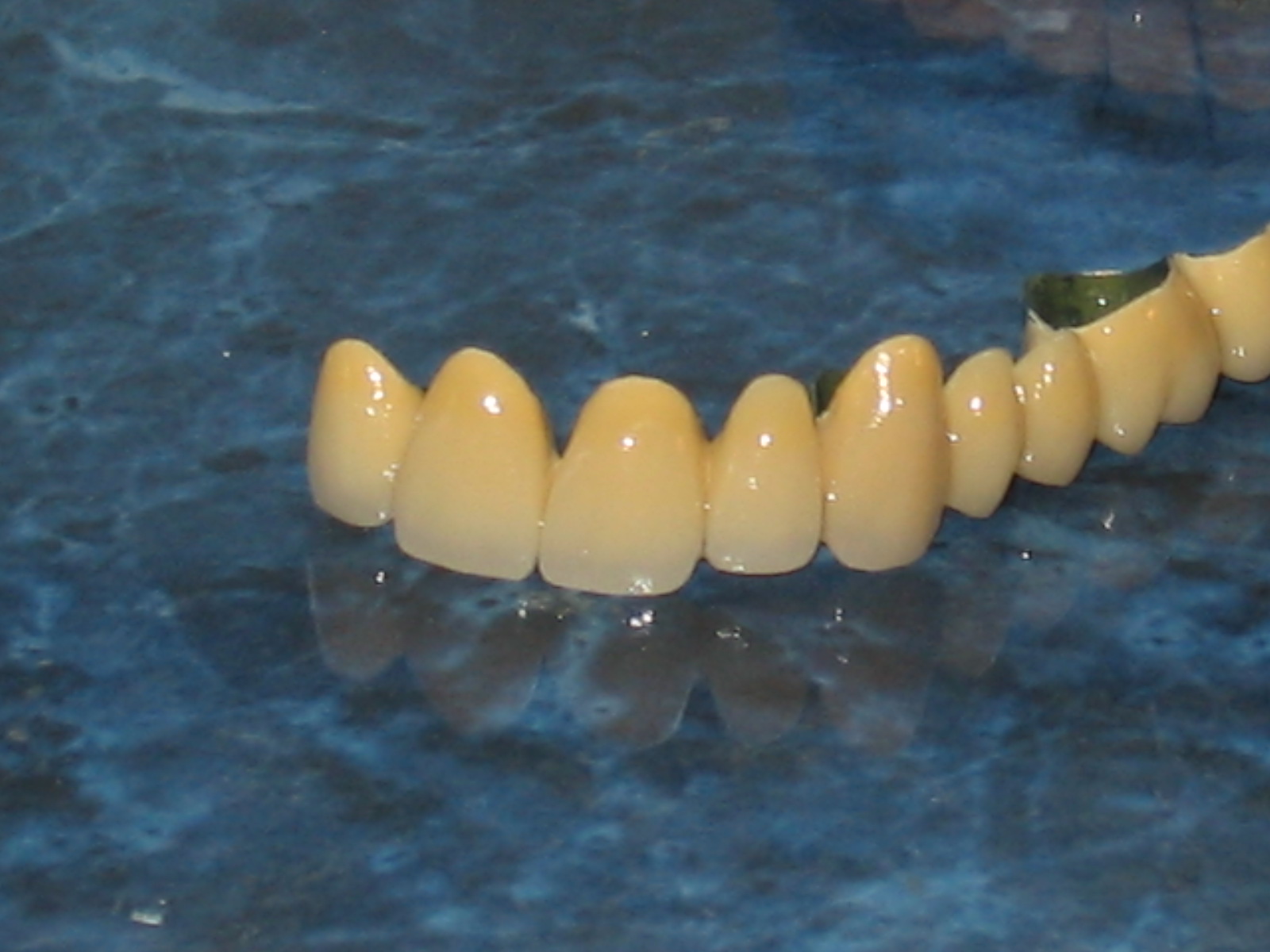 Laborator Dentar Szabo Claudia poza 2