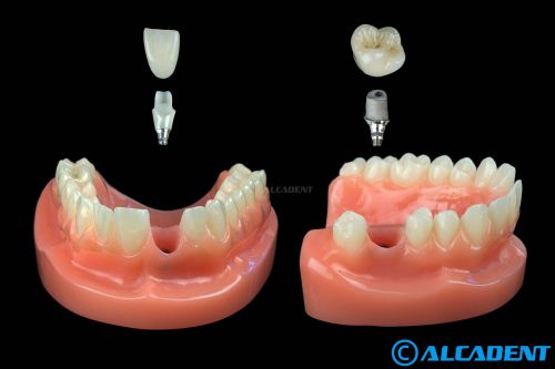 Alcadent Dental Health poza 5