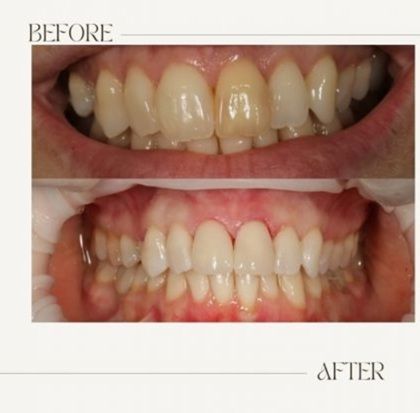 Dental Zen Estetic poza 8