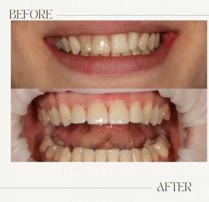 Dental Zen Estetic poza 7