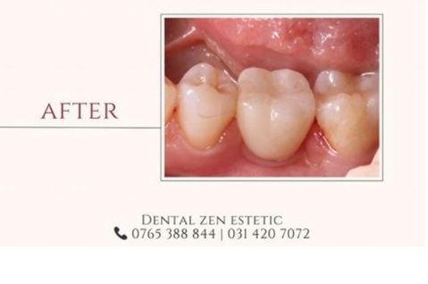 Dental Zen Estetic poza 13