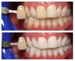 Dentist Bistrita poza 