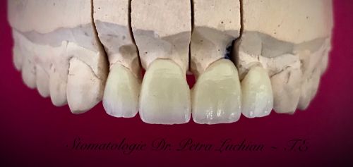Stomatologie Dr. Petra Luchian poza 