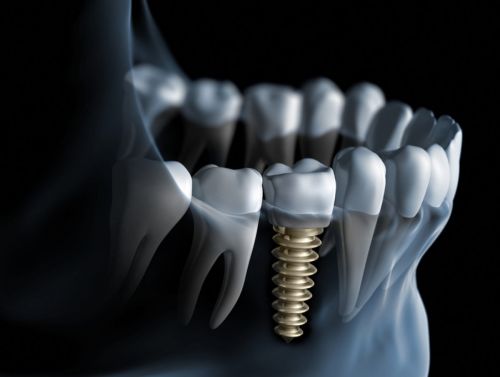 AVA dentistry poza 