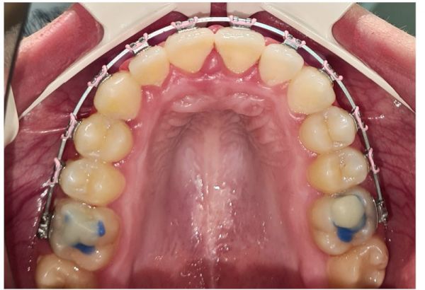 DentArbre poza 12