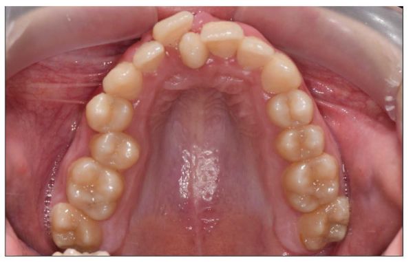 DentArbre poza 11
