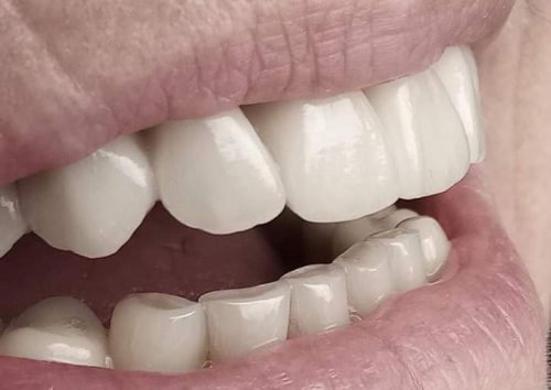 Vision Dent Technology S.r.l. poza 