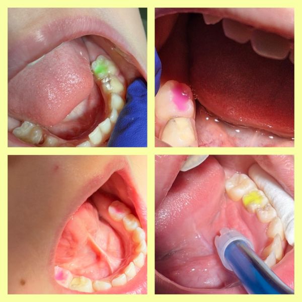 Dr Georgiana Simion Ionica poza 2