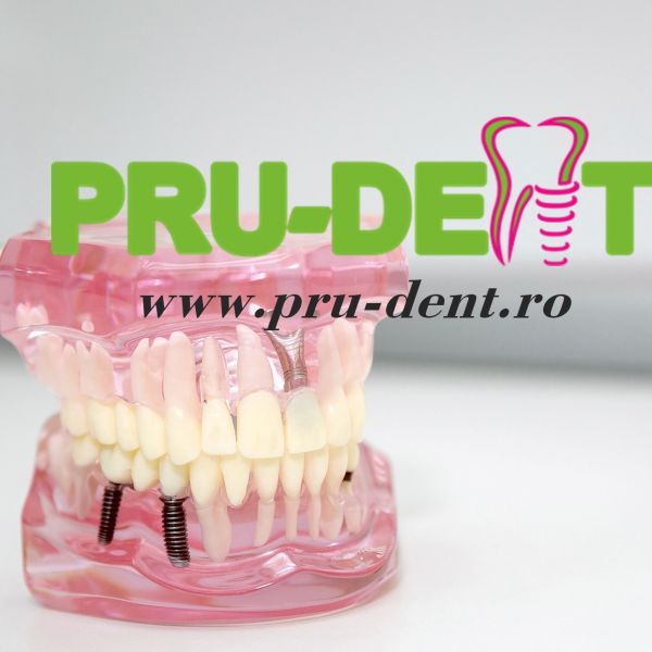 PruDent Brasov - Dr. Pruteanu Vasile poza 17