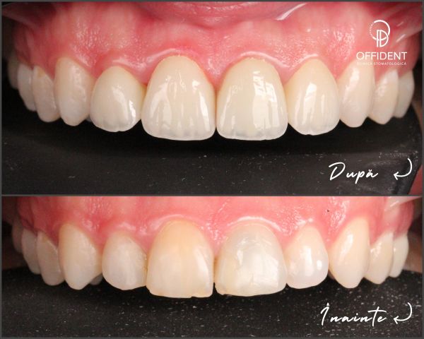Offident Clinica Stomatologica poza 20