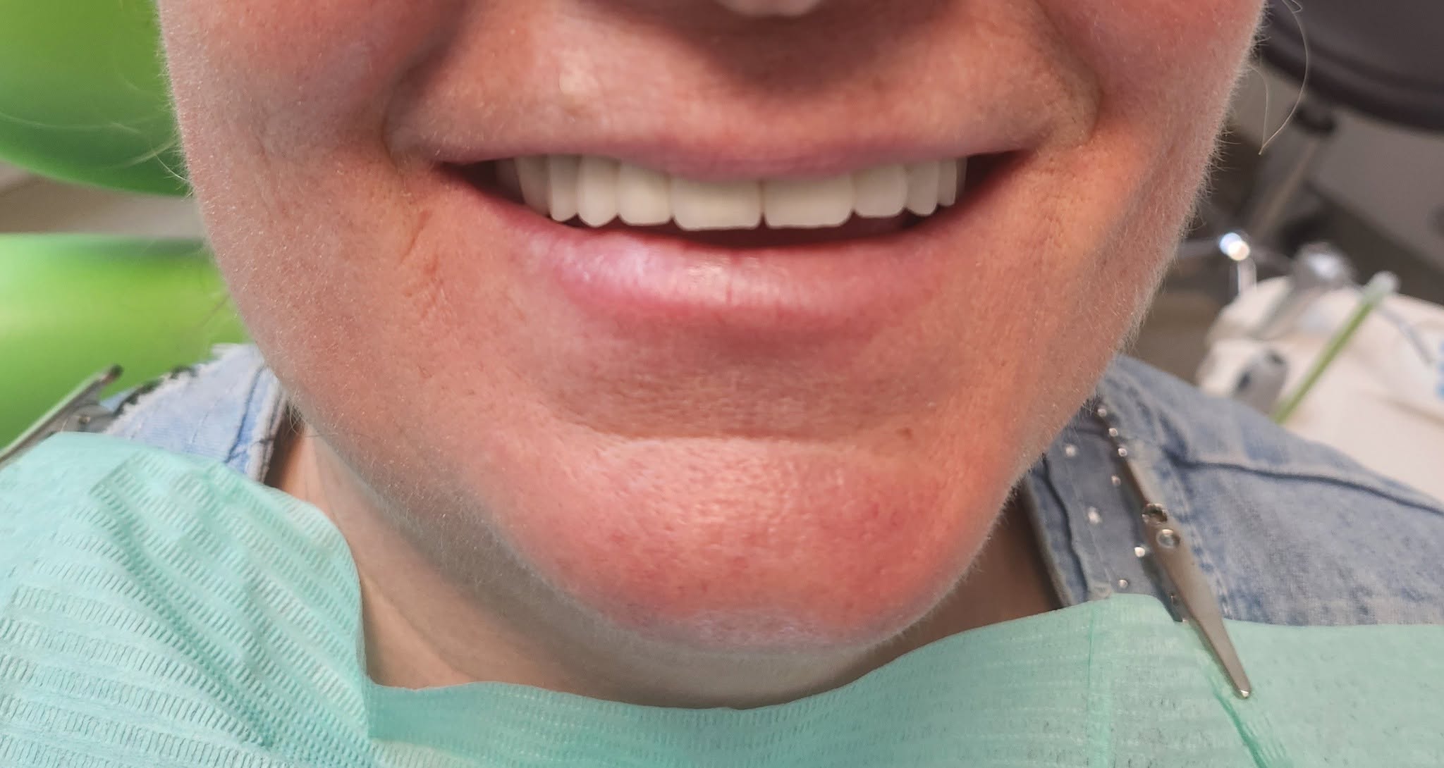 Dental Repair & Protect poza 8