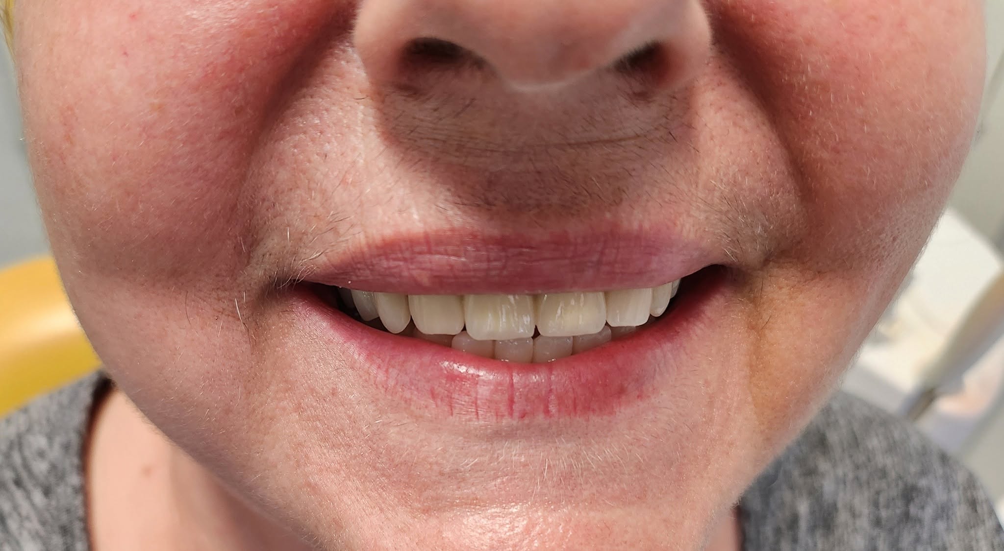 Dental Repair & Protect poza 6