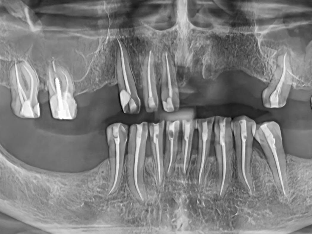 Dental Repair & Protect poza 5