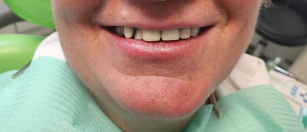 Dental Repair & Protect poza 7