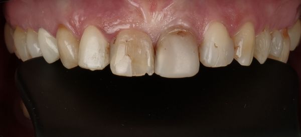 Sc Smileway Stoma Clinic poza 12