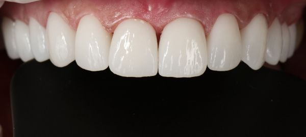 Sc Smileway Stoma Clinic poza 13