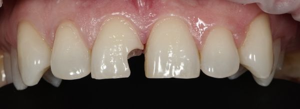 Sc Smileway Stoma Clinic poza 14