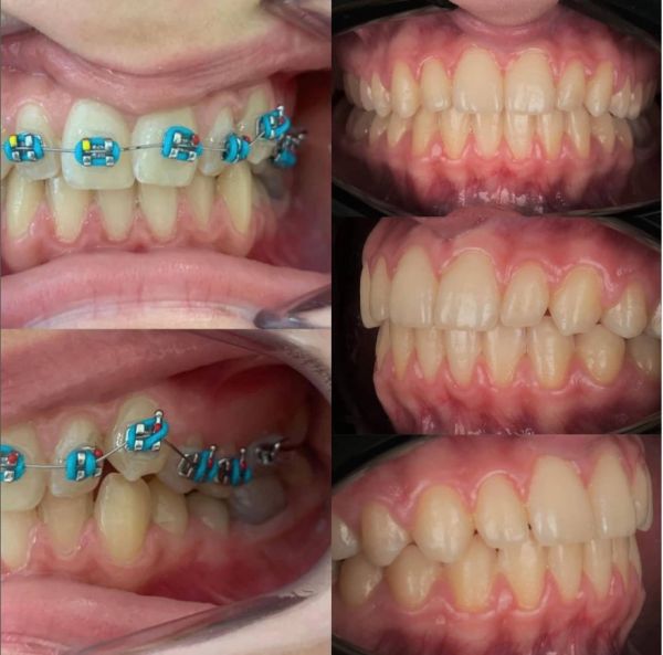 Sc Smileway Stoma Clinic poza 17
