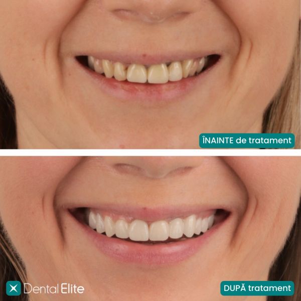 CLINICA DENTAL ELITE poza 19