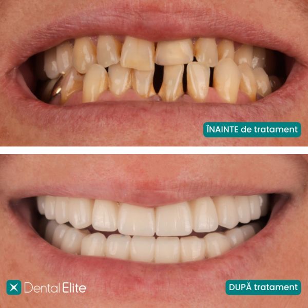 CLINICA DENTAL ELITE poza 14