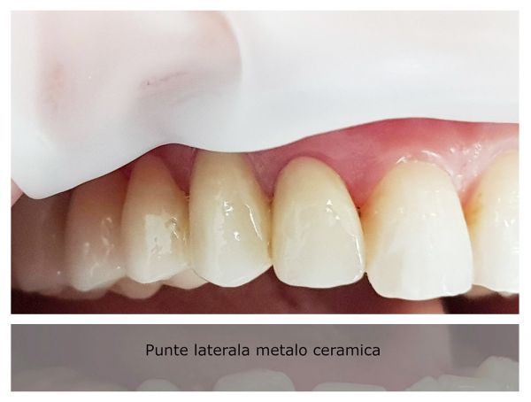 Alkaterra Dental poza 9