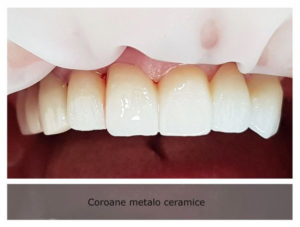 Alkaterra Dental poza 19