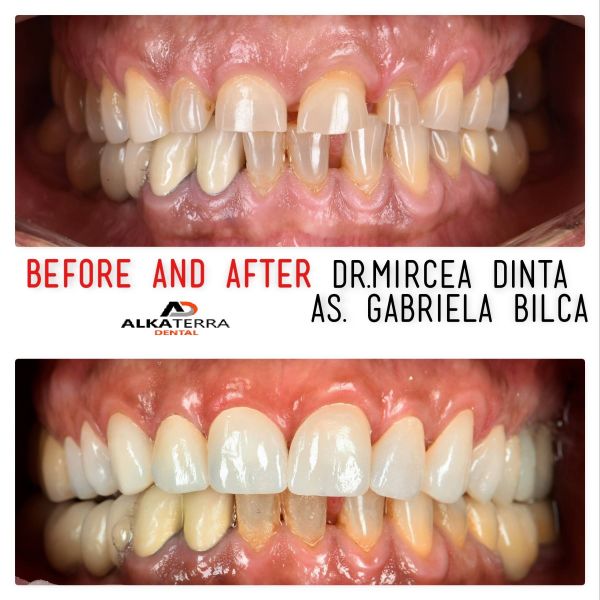 Alkaterra Dental poza 8
