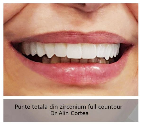 Alkaterra Dental poza 20
