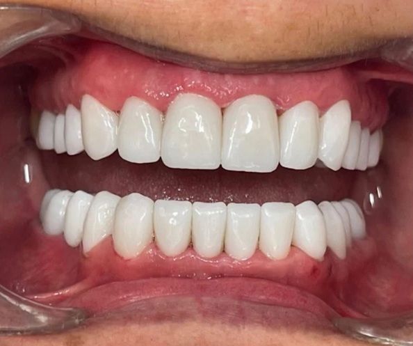 Dental Blue Constanta poza 8