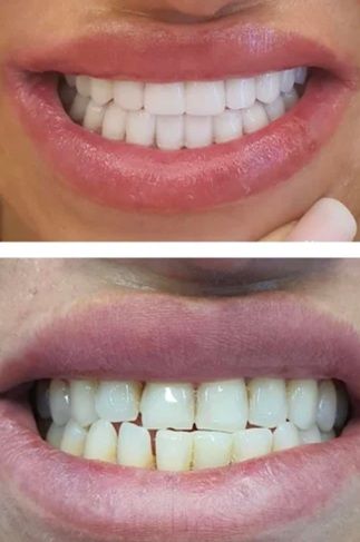 Dental Blue Constanta poza 5