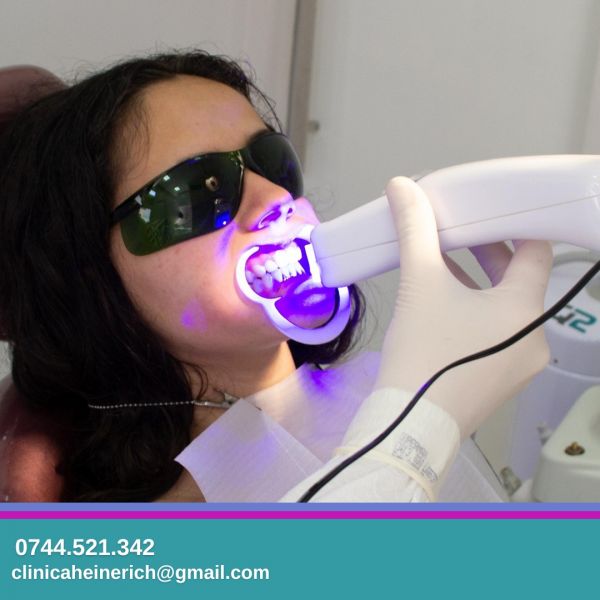 Heinerich - Clinica Stomatologica Sector 6 - Implant Dentar Drumul Taberei poza 11
